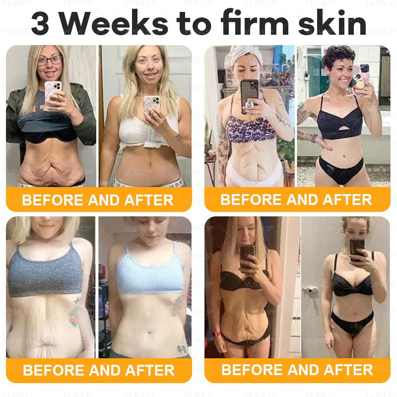 💥💥Made and Shipped from AU ✨ VLSVLS® Bee Venom Skin Restoration Cream 🌸 Anti-aging,Hydrating, Skin Repair, Even Tone, Acne and Dark Spot Treatment, Wart and Mole Removal, Psoriasis Relief 🔥 LAST DAY 80% OFF 💎