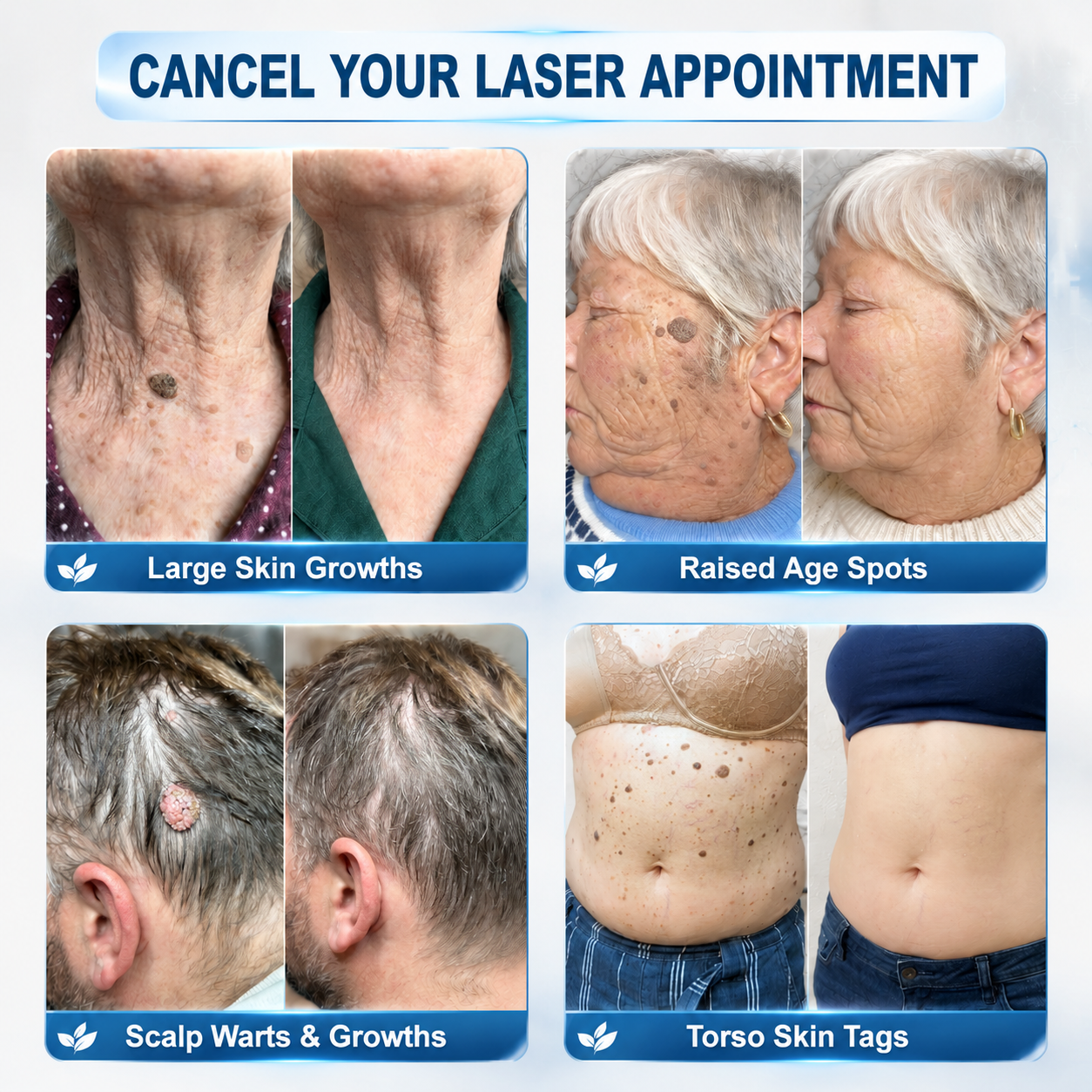 𝐇𝐈𝐒𝐊𝐈𝐍®👩‍⚕️ 𝟕-𝐃𝒂𝘆 𝐒𝗸𝐢𝐧 𝐓𝒂𝗴 & 𝐒𝐩𝙤𝐭 𝐄𝐫𝒂𝐬𝙚𝐫 Painless & Scar-Free Advanced Imper✨✨✨✨