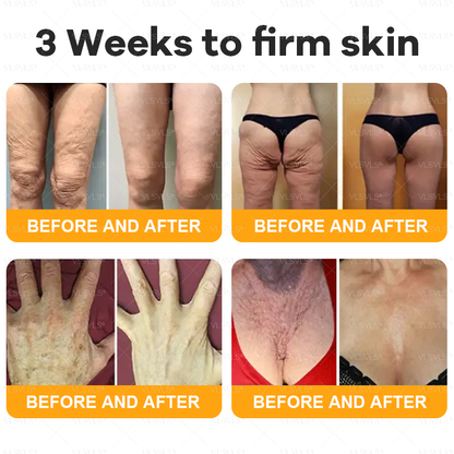 💥💥Made and Shipped from AU ✨ VLSVLS® Bee Venom Skin Restoration Cream 🌸 Anti-aging,Hydrating, Skin Repair, Even Tone, Acne and Dark Spot Treatment, Wart and Mole Removal, Psoriasis Relief 🔥 LAST DAY 80% OFF 💎