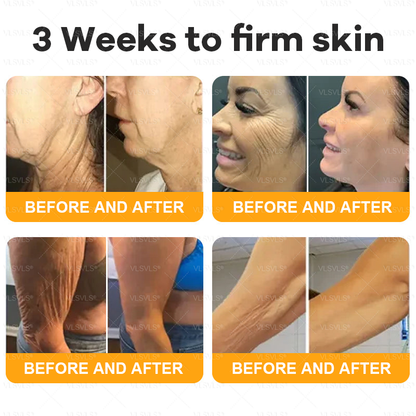 💥💥Made and Shipped from AU ✨ VLSVLS® Bee Venom Skin Restoration Cream 🌸 Anti-aging,Hydrating, Skin Repair, Even Tone, Acne and Dark Spot Treatment, Wart and Mole Removal, Psoriasis Relief 🔥 LAST DAY 80% OFF 💎